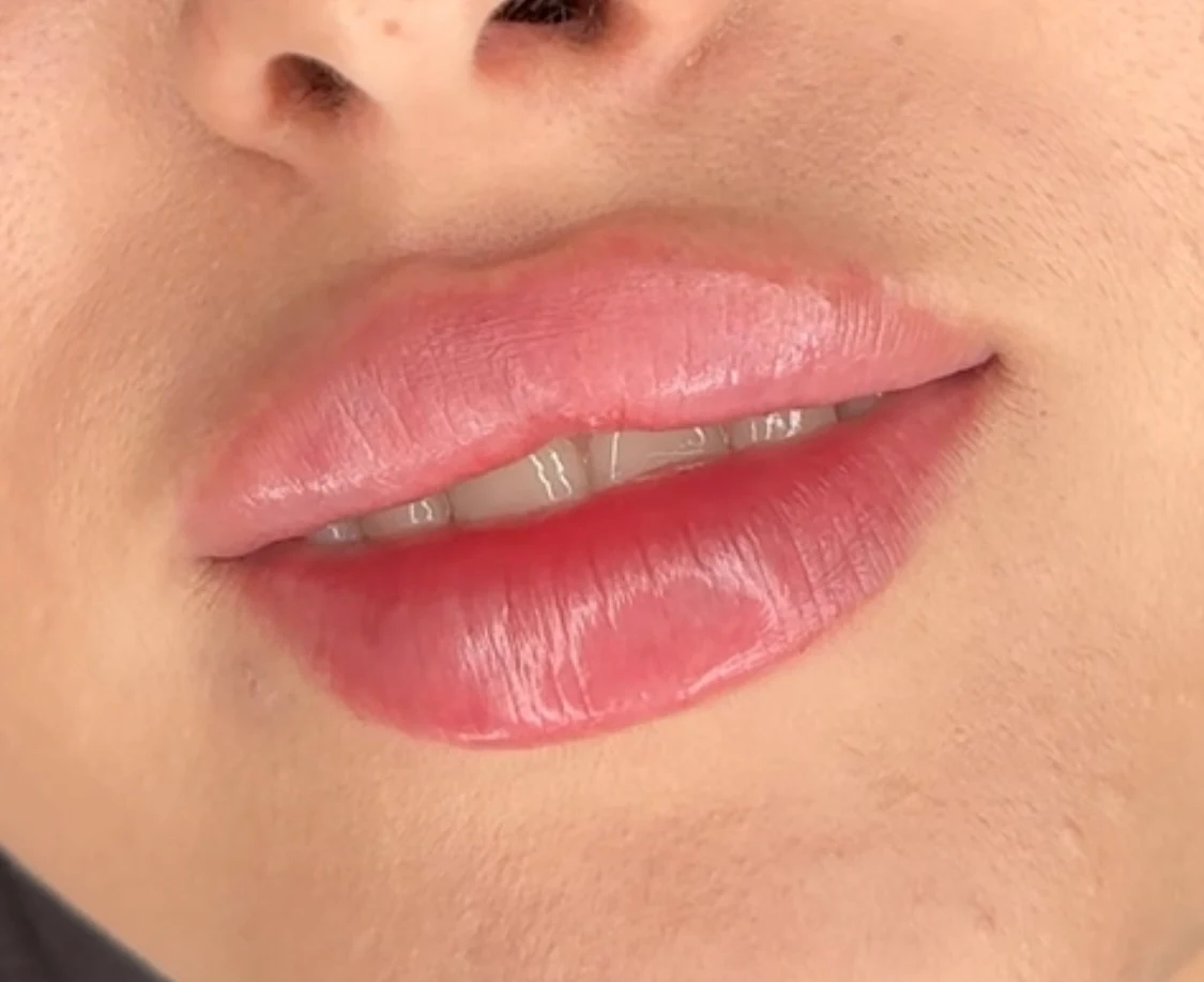 Usta po zabiegu - delikatny połysk i nawilżenie, ETERNA ESTETYKA Gliwice